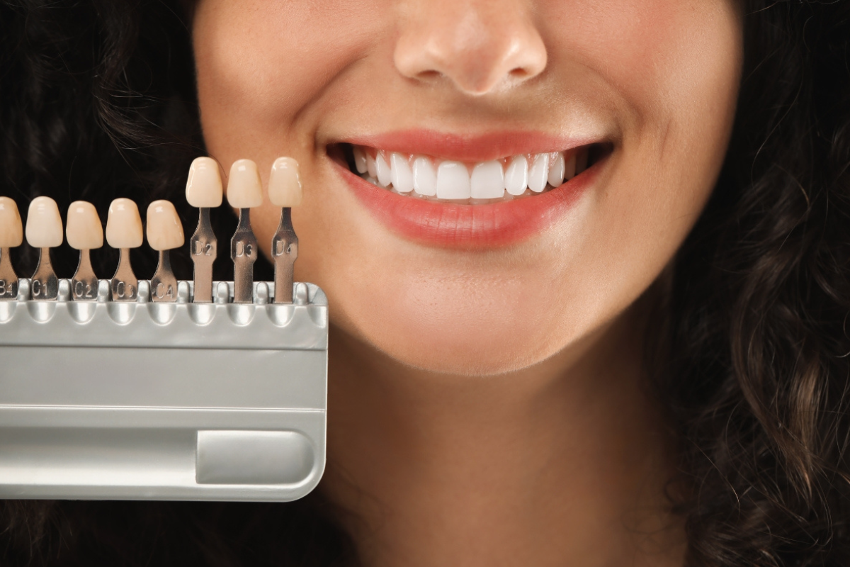 Dental Veneers owasso