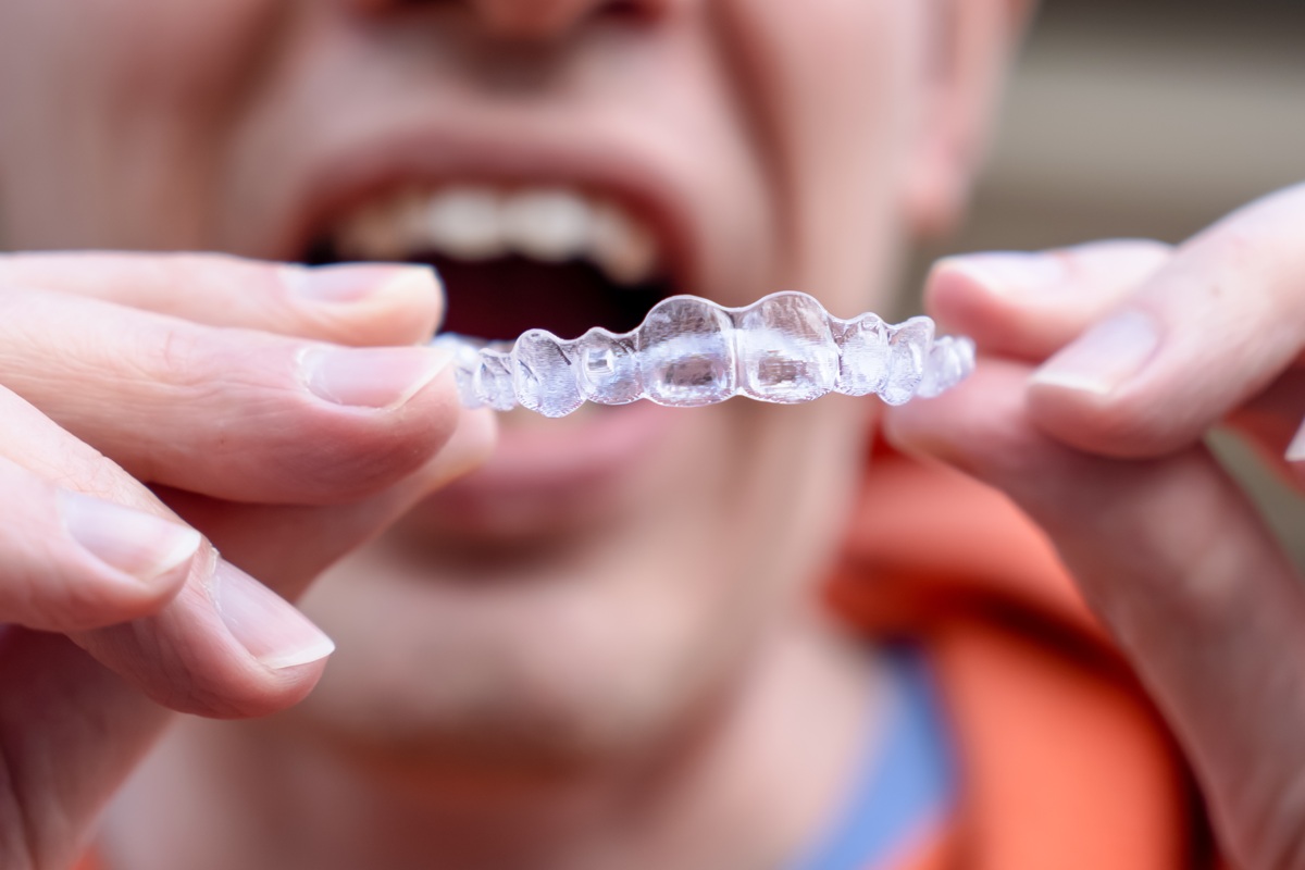 Patient holding Invisalign aligners