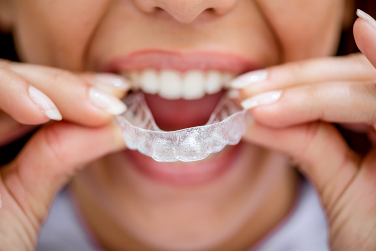 Person wearing Invisalign for straighter smile