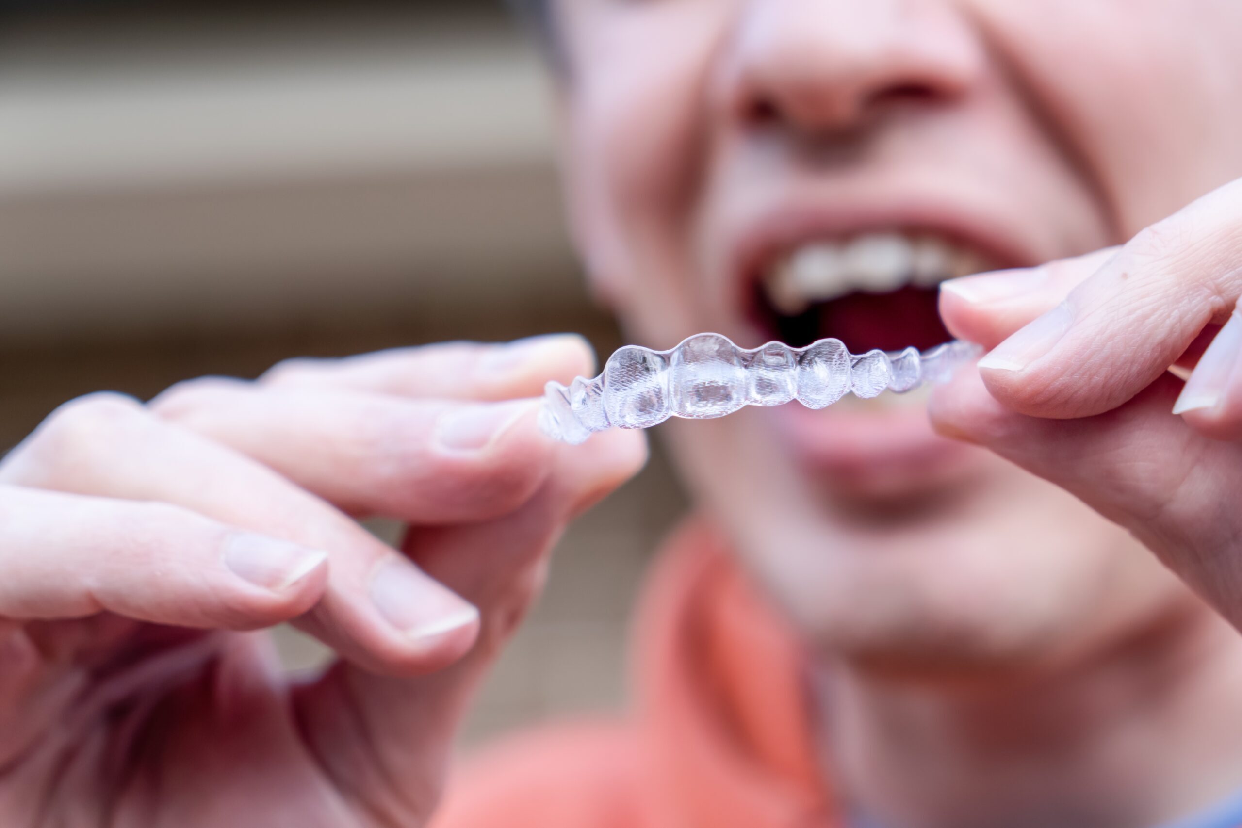 Person holding an Invisalign clear aligner tray for teeth straightening treatment.